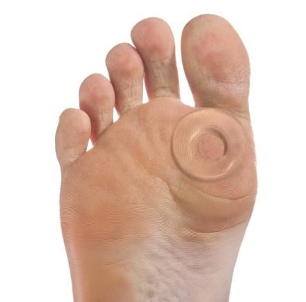 All Gel Cushion